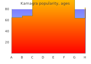 purchase kamagra 50 mg online