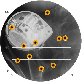 Paroxysmal dystonic choreoathetosis