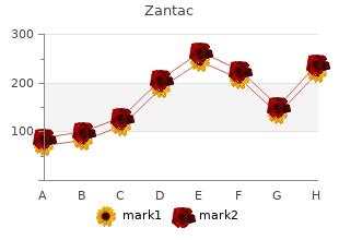 zantac 150mg with mastercard