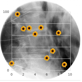 Choroido cerebral calcification syndrome infantile