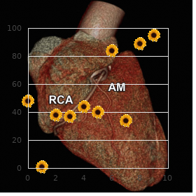 Dextrocardia