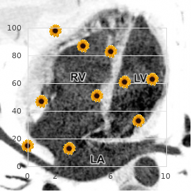 Sensory processing disorder
