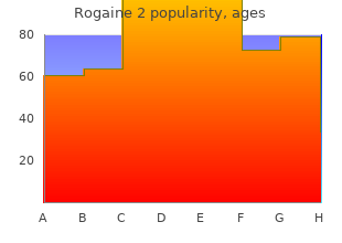 purchase rogaine 2 uk