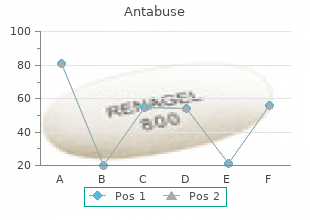 buy line antabuse