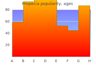 discount propecia 5 mg without a prescription