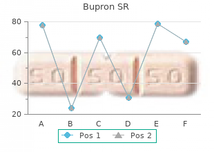 bupron sr 150 mg fast delivery