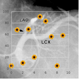 Hypohidrotic Ectodermal Dysplasia