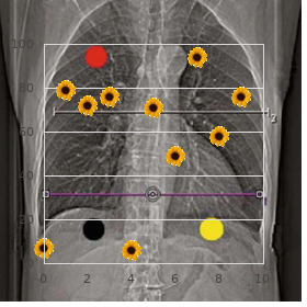 Susac syndrome