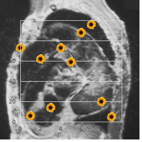 Morphea scleroderma