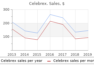 order celebrex now