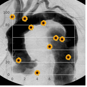 Deafness epiphyseal dysplasia short stature