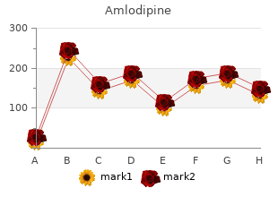 discount amlodipine 10mg fast delivery