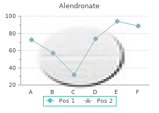 order generic alendronate line