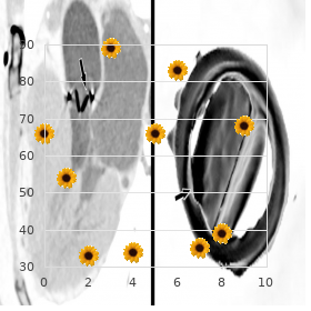 Retinoschisis, juvenile
