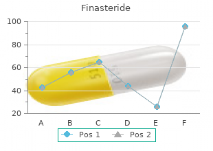 buy finasteride us