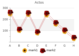order cheap actos line
