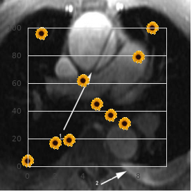 Developmental dysphasia familial