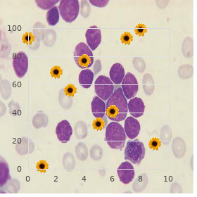 Methylmalonic acidemia with homocystinuria