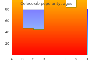 buy celecoxib 200mg low price