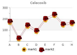 purchase celecoxib now