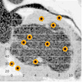 Succinic acidemia