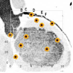 Light chain disease