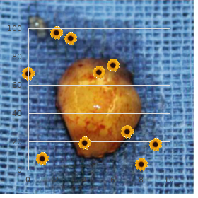 Gitelman syndrome