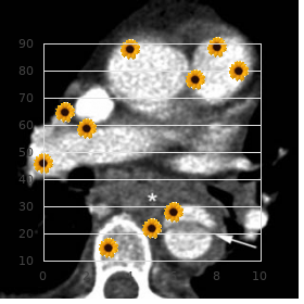 Rowley Rosenberg syndrome