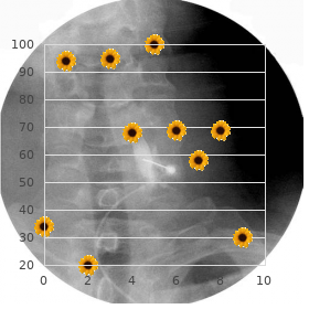 Skeletal dysplasias