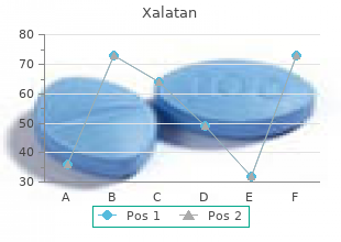 buy line xalatan