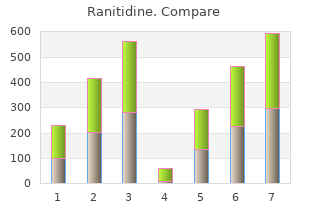 generic 300 mg ranitidine otc