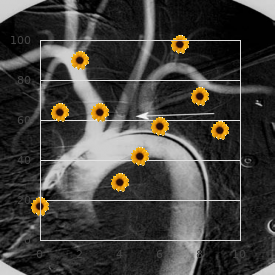 1p36 deletion syndrome, rare (NIH)