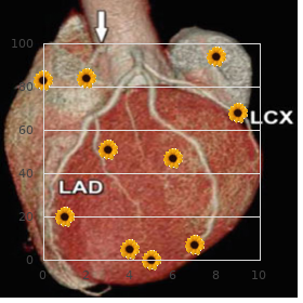 Defective apolipoprotein B-100