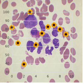 Systemic necrotizing angeitis