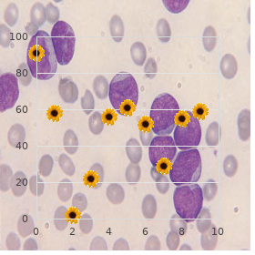 Hemifacial microsomia