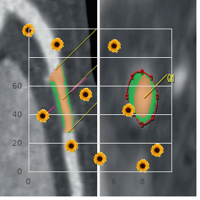 Limb deficiencies distal micrognathia