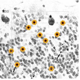 Acromesomelic dysplasia Hunter Thompson type