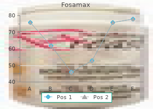 fosamax 70 mg on line