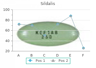 order sildalis on line amex