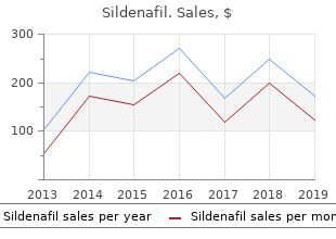 buy 75 mg sildenafil free shipping