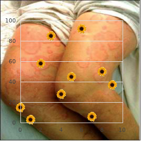 Macular degeneration juvenile