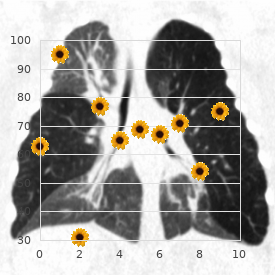 Myopathy, myotubular