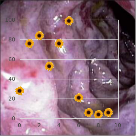 Pancreatic islet cell tumors