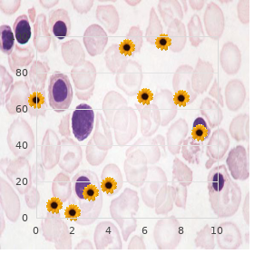 Histiocytosis X