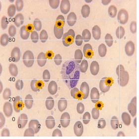 Behrens Baumann Dust syndrome