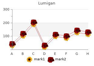 buy discount lumigan 3ml on-line