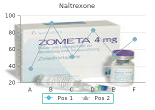 generic naltrexone 50 mg with visa