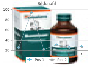 generic sildenafil 100mg visa