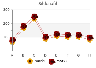 discount sildenafil 25 mg with amex