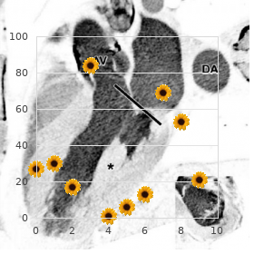 Chromosome 15q, partial deletion